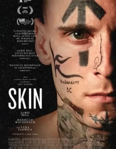 skin-235x300